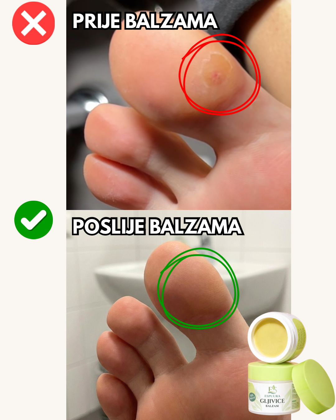 Biljni balzam protiv gljivica